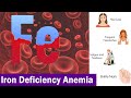 Iron Deficiency Anemia ( Clear & Complete Overview )