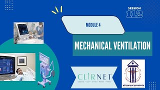 Mechanical Ventilation: Module 4 ICA Webinar