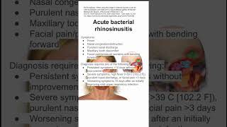 Acute bacterial rhinosinusitis