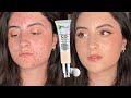 LIGHT WEIGHT FULL COVERAGE FOR ACNE SKIN | It Cosmetics Your Skin But Better CC+ Cream with SPF 50+