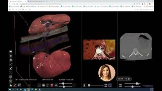 Anatomage: High Resolution Kidney- Version 8