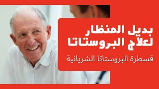 قسطرة البروستاتا الشريانية : بديل المنظار الجراحي لمرضي تضخم البروستاتا الحميد