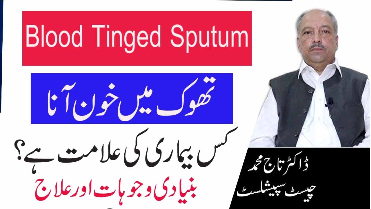 Blood Tinged Sputum Causes And Treatment In Urdu | Moo Sy Khoon Ane Ka ...