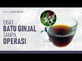 Resep Minuman Alami Menghancurkan Batu Ginjal | Hidup Sehat tvOne