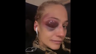 Ebanie Bridges - Post-Fight Message After Fight With Shannon Courtenay