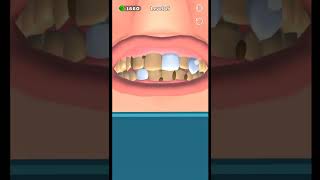 master doctor 3d game how teeth cleaning level 15. #shorts