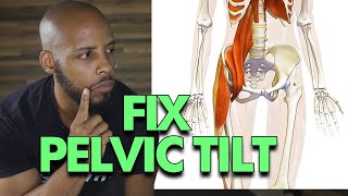 How you walk can fix your Anterior Pelvic Tilt and Posterior Pelvic Tilt