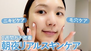 【ガチ愛用スキンケアのみ】ニキビと毛穴ケアに格闘する7日間の朝夜スキンケアルーティン🛀おすすめアイテム大量紹介【プチプラ/デパコス】