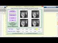 Image Compression Using Modified Haar Wavelet Transform Using Matlab Project Code