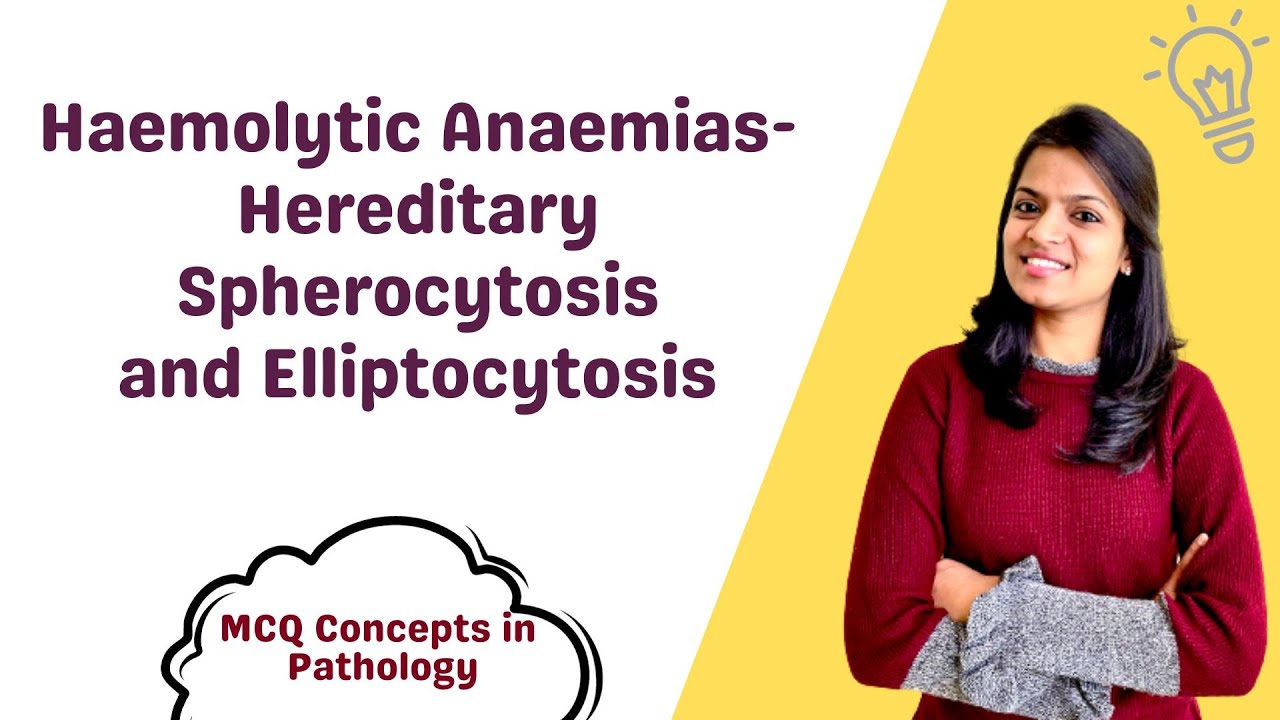 Haemolytic Anaemias- Hereditary Spherocytosis And Elliptocytosis - MCQ ...