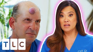 Dr Lee Worried This Man's Bump Is About To Explode! | Dr Pimple Popper