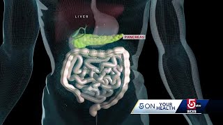 Mass. doctor fact checks gut health trends