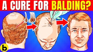 New Research Suggests Balding Is Avoidable