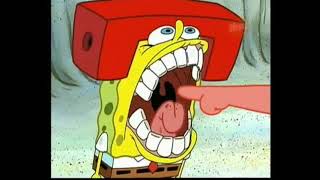 SpongeBob Bites Sid Phillips