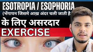 Best eye Exercise for Esotropia | Best eye exercise for squint Eye