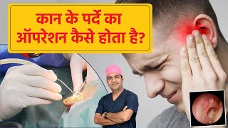 कान के पर्दे का ऑपरेशन  कैसे होता है | Know About Eardrum Surgery | Dr Sunil Tanvar | #eardrum