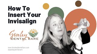 How to Insert Invisalign