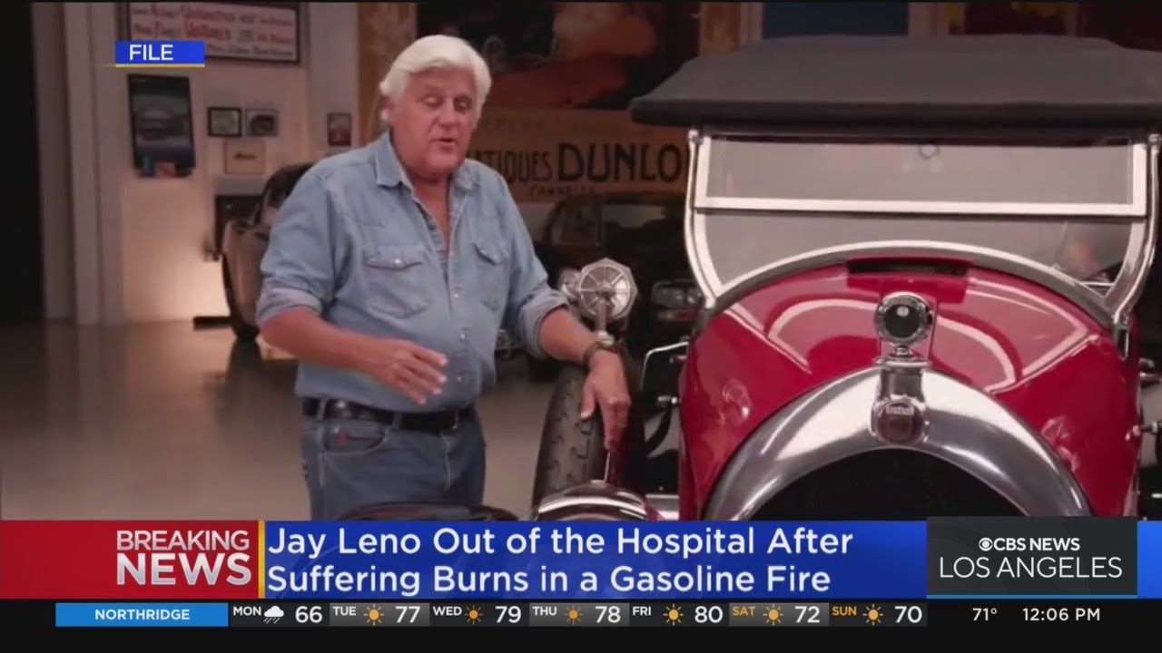 Jay Leno Released From Hospital After Receiving Treatment For Burns ...