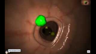 EndoSim Fundamental Endoscopy Skills 1: Button Handling