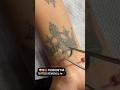 permanent tattoo removal best'price Hyderabad