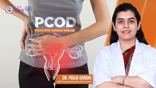PCOD (Polycystic Ovarian Disorder): Causes, Symptoms, Diagnosis, Diet & Treatment