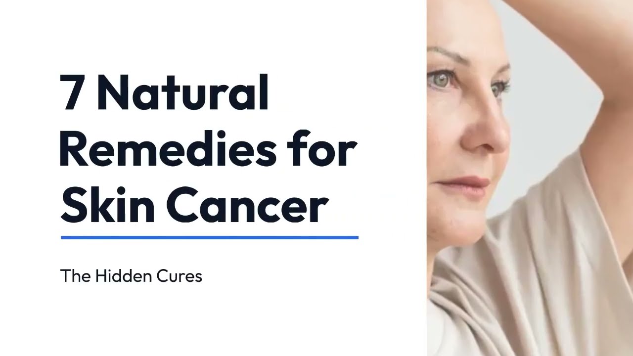 7 Natural Remedies For Skin Cancer - YouTube