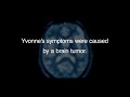 Brain Tumor Treatment Success - Raleigh Neurosurgical Clinic