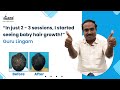 What Treatment Fixed Guru Lingam’s Hair Loss? Find Out Here!