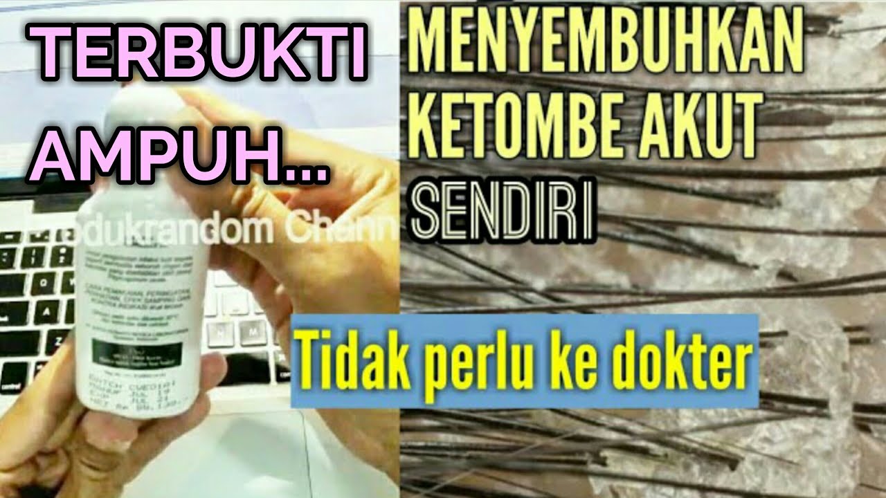 CARA MENGOBATI KETOMBE BERKERAK TEBAL DI KULIT KEPALA AKUT (MEMBASMI ...