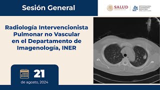 SESIÓN GENERAL: Radiología Intervencionista Pulmonar no Vascular en el Departamento de Imagenología