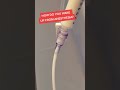 How You Wake From Anesthesia