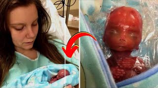 10 Most UNUSUAL Babies That Were Born Different