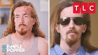 Most Insane Transformations! | Dr. Pimple Popper | TLC