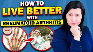Rheumatoid arthritis: Best Tips to Live Better