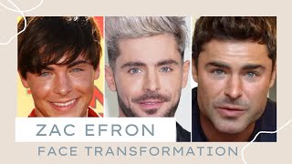 Zac Efron Face Transformation: Explained by a Plastic Surgeon