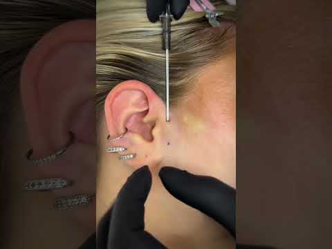 Is a tragus piercing a surface piercing?
