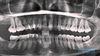 X-rays - Lapointe dental centres