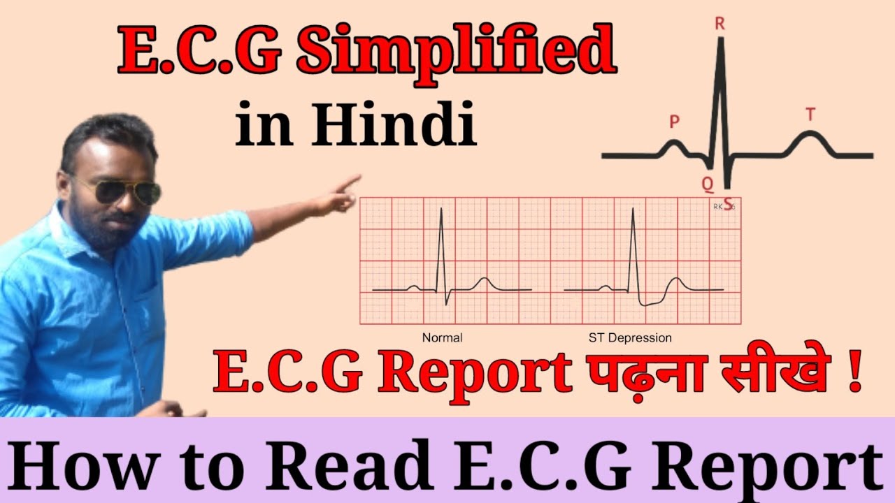 ECG Report Kaise Dekhe || How To Read ECG Report || ECG Reading In ...