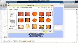 Matlab Code On Diabetic Retinopathy Classification Using Image Processing | With Source Code