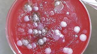 Bio-agent | Wikipedia audio article