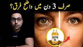 Castor Oil for Your Face | Dr. Zee | डॉक्टर ज़ी