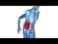 Back Pain Linked to Knee Pain