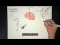 What is Brain Computer Interface and how can it help stroke patients recover mobility?