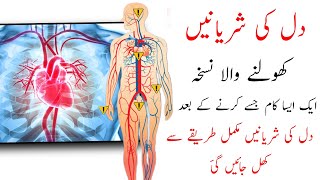 Arteries of the heart | dil ki sharyeny | دل کی شریانیں کھولنے| Treatment| Rj Yasir