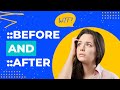 Learn CSS Before & After Pseudo Elements: The Most Confusing Part of CSS?