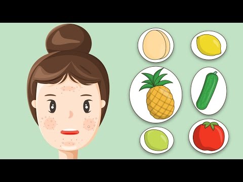 6 Home Remedies to Get Rid of Oily Skin 6 Home Remedies to Get Rid of Oily Skin