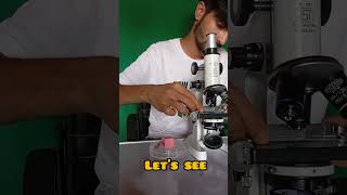 Dandruff under microscope 🤔 #viralvedio #microscope #shorts