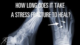 How long does it take a stress fracture to heal?