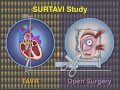 Transcatheter Aortic-Valve Replacement