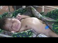 Pumani bCPAP Training Films: Section 2 - When Does a Child Need CPAP?